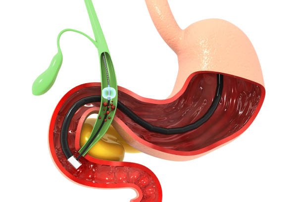 best laparoscopic surgeon for gall bladder surgery in mumbai
