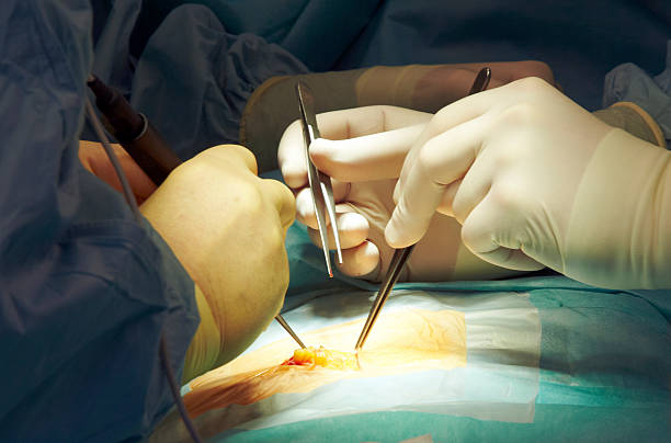 best laparoscopic surgeon for hernia repair in mumbai